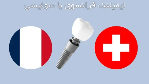 ایمپلنت فرانسوی یا سوئیسی?