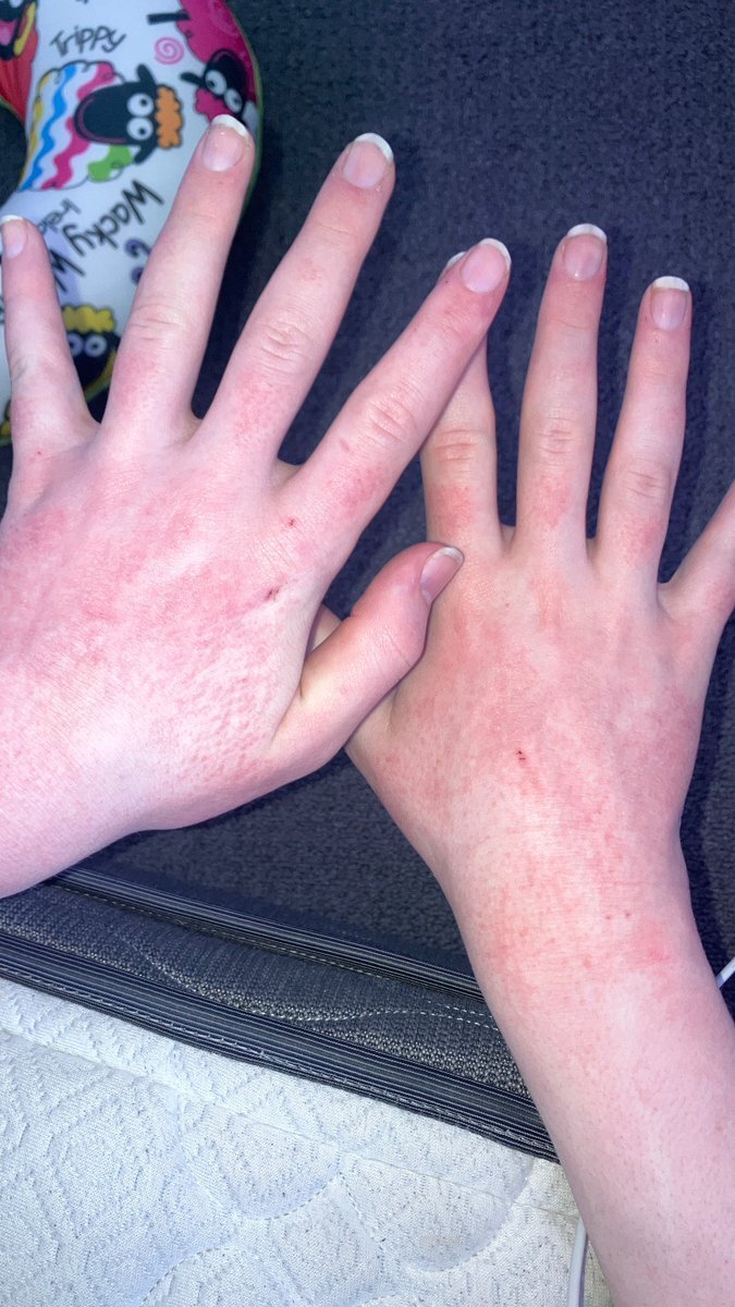 streamrs hand